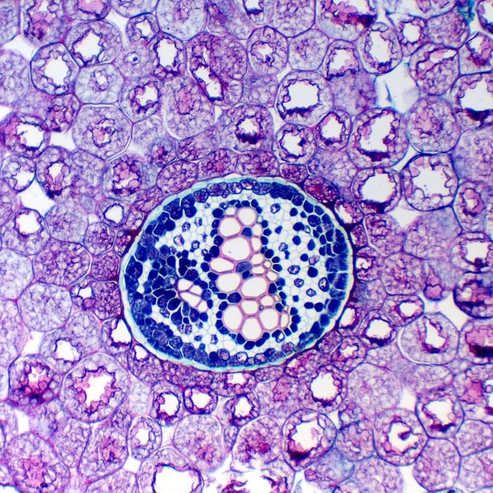 Delta Optical Genetic Bino microscope