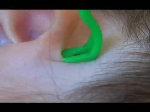 Tick Twister Trio kullancseltávolító kampó